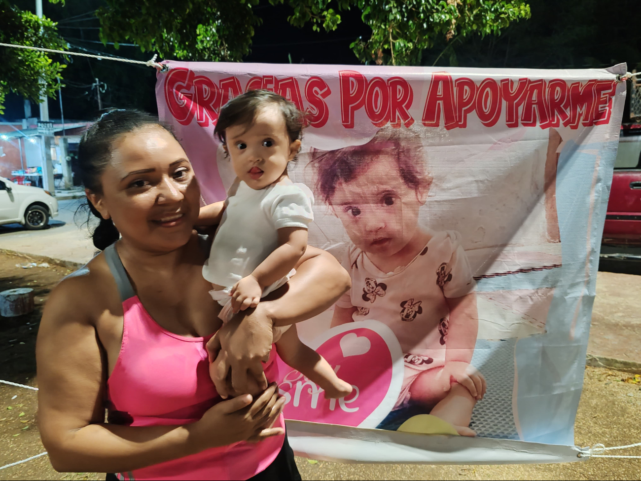 Esme, la niña de sonrisa valiente, necesita una operación urgente Esme, la niña de sonrisa valiente, necesita una operación urgente