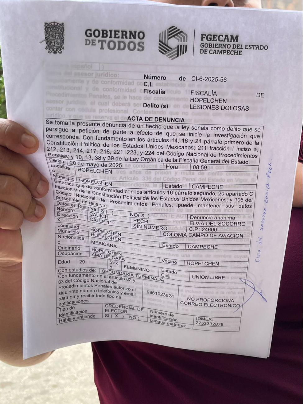 Teme por su vida: mujer denuncia que FGE no actuó tras ataque de su pareja Teme por su vida: mujer denuncia que FGE no actuó tras ataque de su pareja