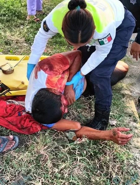 Hombre en estado de ebriedad se impacta contra una palmera en Chetumal y sufre lesiones en la cabeza 