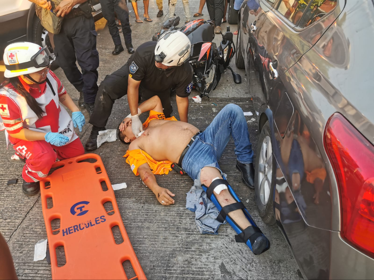 La lesión que sufrió el motociclista fue grave, por lo que tuvo que ser trasladado.