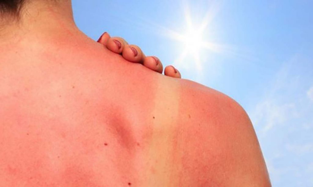 “Melanoma maligno, el que cobra más vidas a nivel mundial’, experto en cáncer de piel explica qué síntomas cuidar