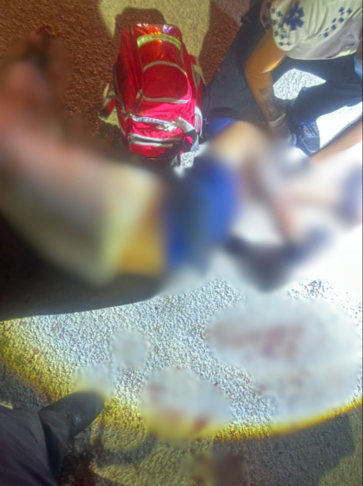 El sujeto, con lesiones visibles, fue trasladado al hospital general.