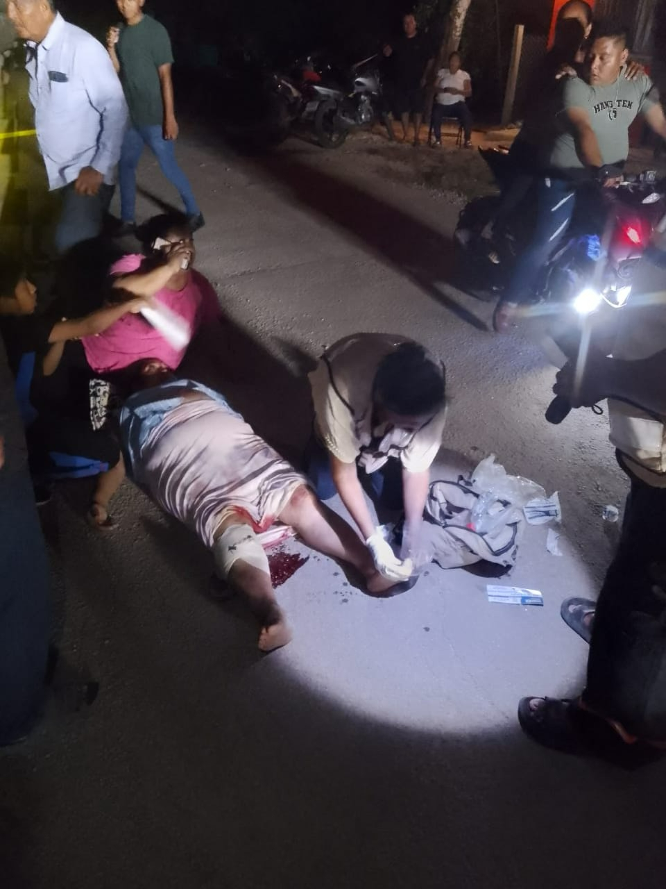 Menor de edad provoca accidente contra mujer de 51 años en la comunidad de Cacao
