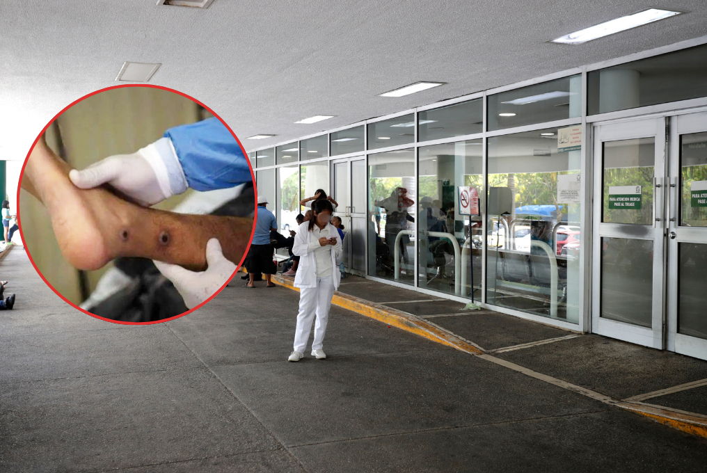 El padecimiento es provocado por un insecto pequeño, el cual transmite un parásito y genera heridas abiertas en la piel que tardan en sanar
