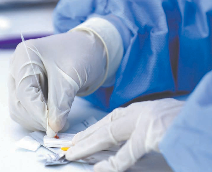De acuerdo con datos del Boletín Epidemiológico Nacional, la candidiasis urogenital es la afección más frecuente en la entidad