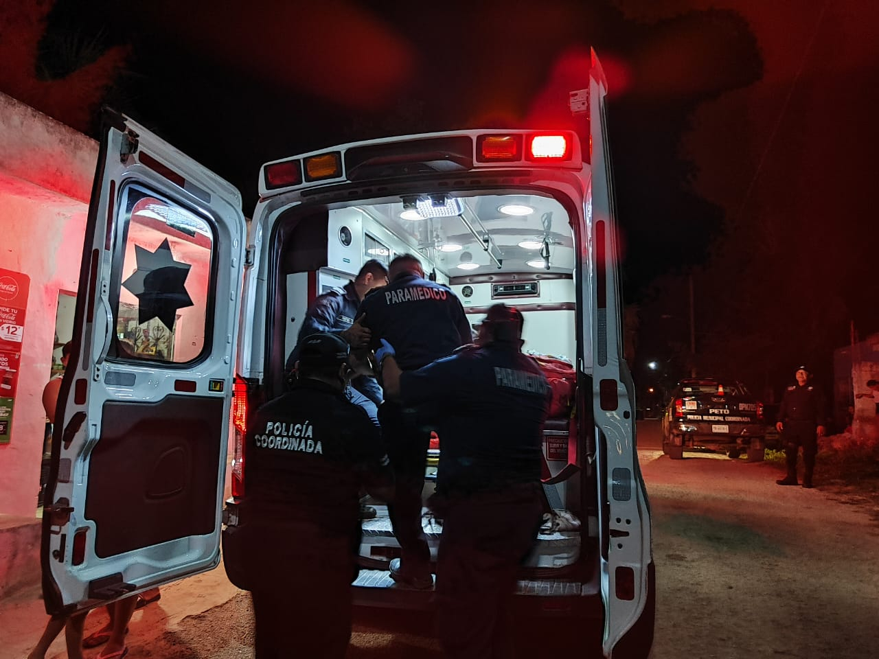 Auxilian a un niño de tres años en Peto luego de que una sombrilla se le atorara en la boca