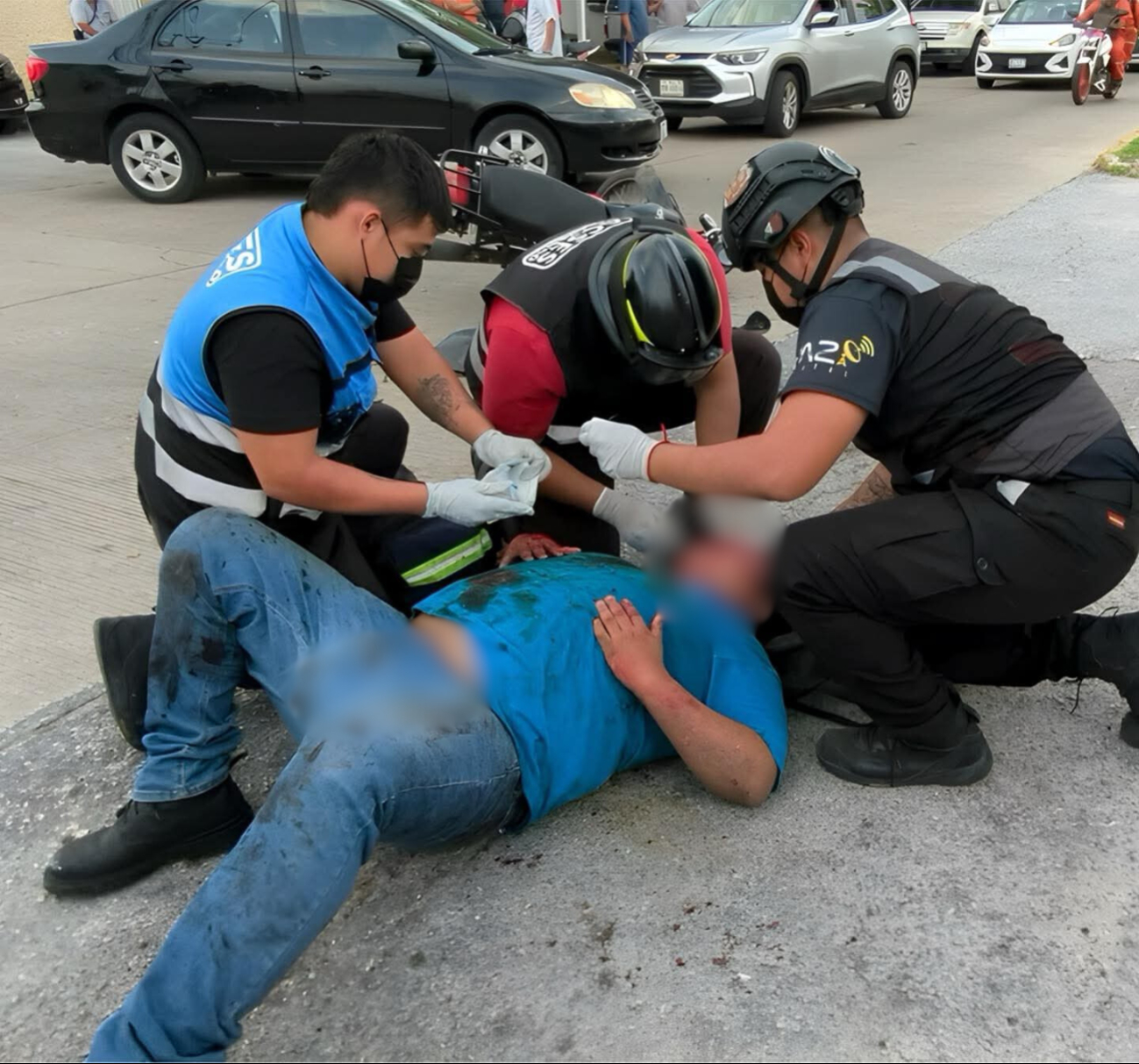 El joven se encuentra intubado, con el rostro desfigurado y riesgo de perder un ojo, además de posibles daños en pulmón y riñón. El joven se encuentra intubado, con el rostro desfigurado y riesgo de perder un ojo, además de posibles daños en pulmón y riñón.