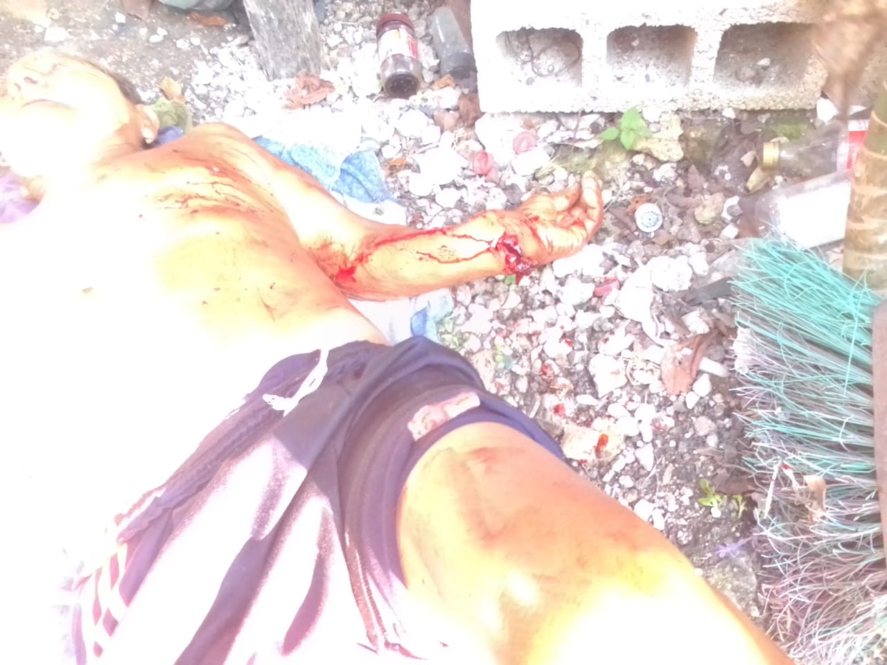 Auxilian a abuelito en Ribera del Río Hondo, Quintana Roo