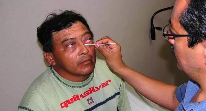 Síntomas y prevención: lo que debes saber sobre la conjuntivitis en temporada de calor Síntomas y prevención: lo que debes saber sobre la conjuntivitis en temporada de calor