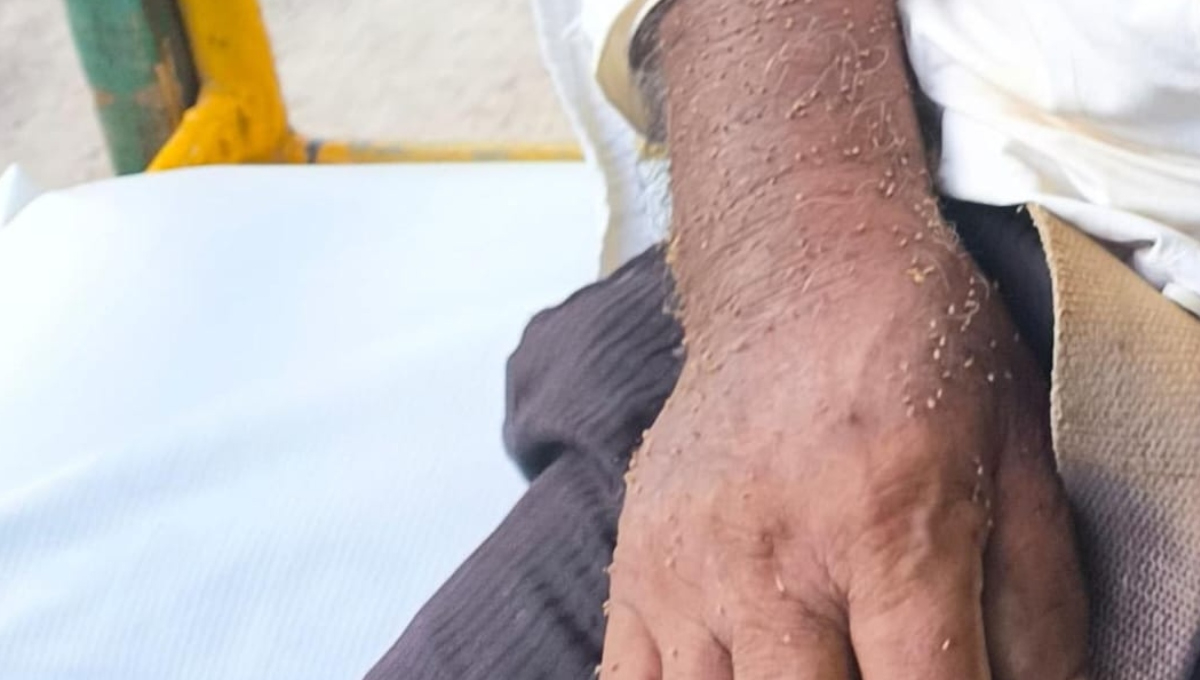 El abuelito fue canalizado al Hospital General de Tekax