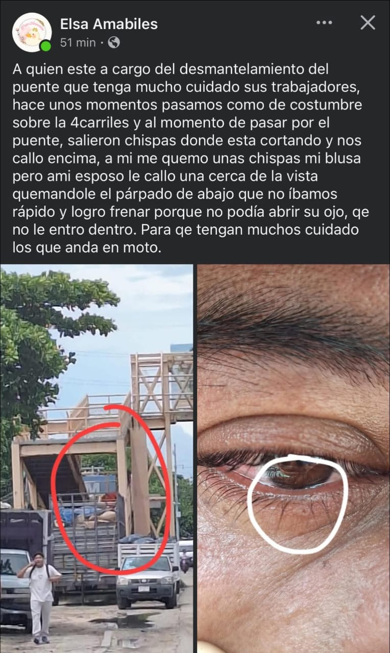 Pareja resulta lesionada por desmantelamiento de puente en Ciudad del Carmen Pareja resulta lesionada por desmantelamiento de puente en Ciudad del Carmen
