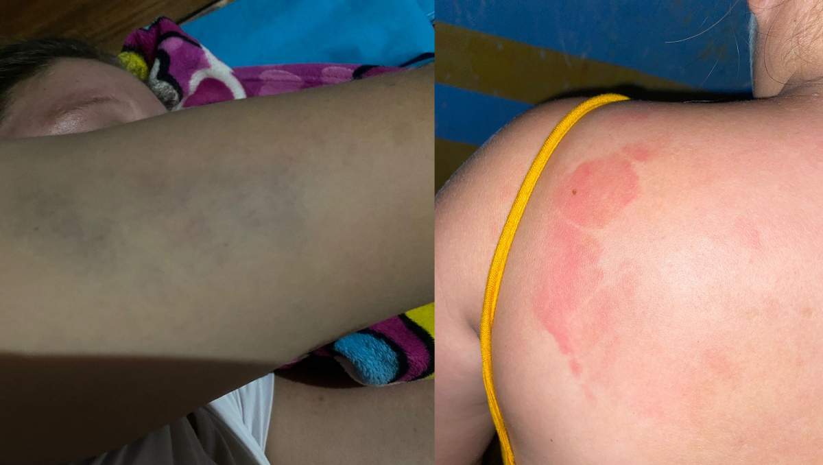 Mujer embarazada desmiente a su suegro en Hopelchén: acusa violencia familiar y no robo policial