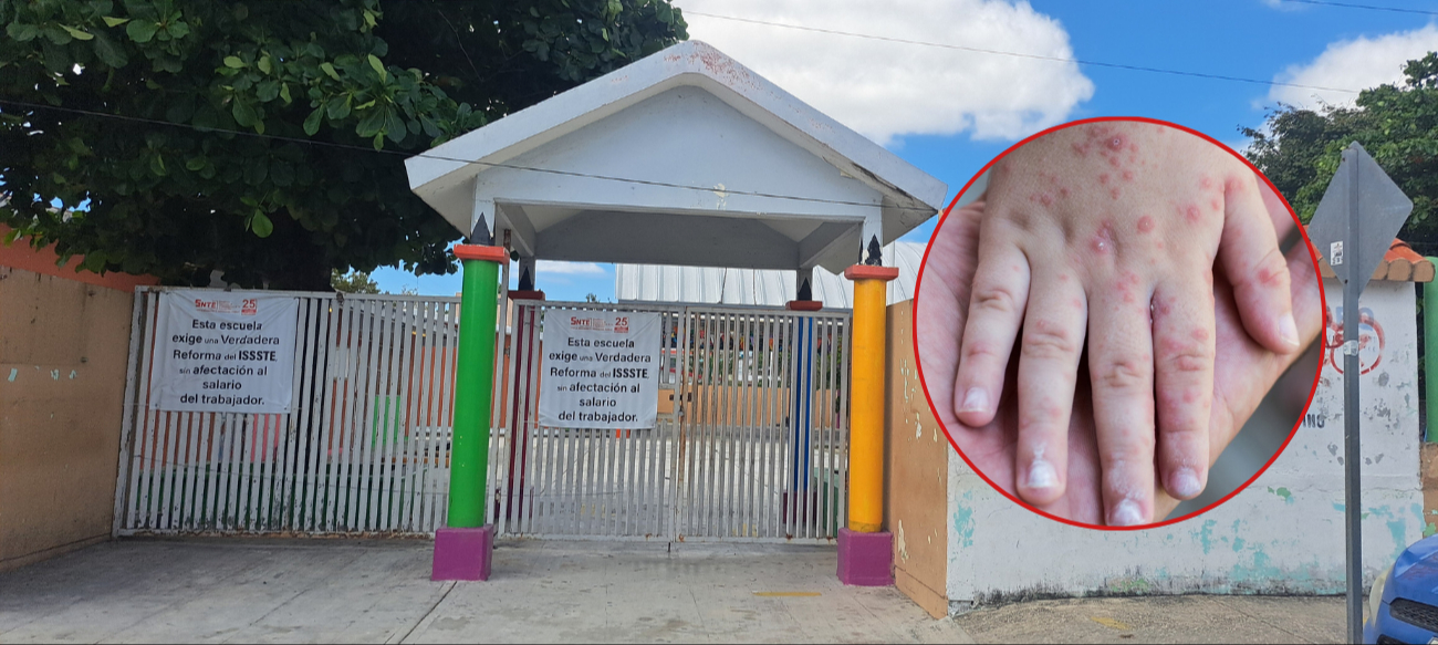 Representantes del municipio pidieron a los padres de familia que no lleven a sus hijos a los centros educativos si sospechan que están enfermos
