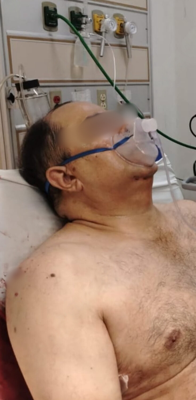 Permanece hospitalizado bajo custodia en el CESAT de Ciudad del Carmen.