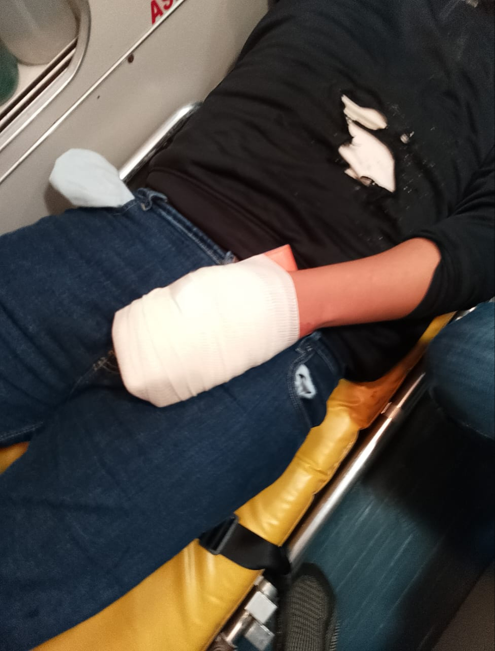 Se presume que perdió una parte de la mano debido a la explosión