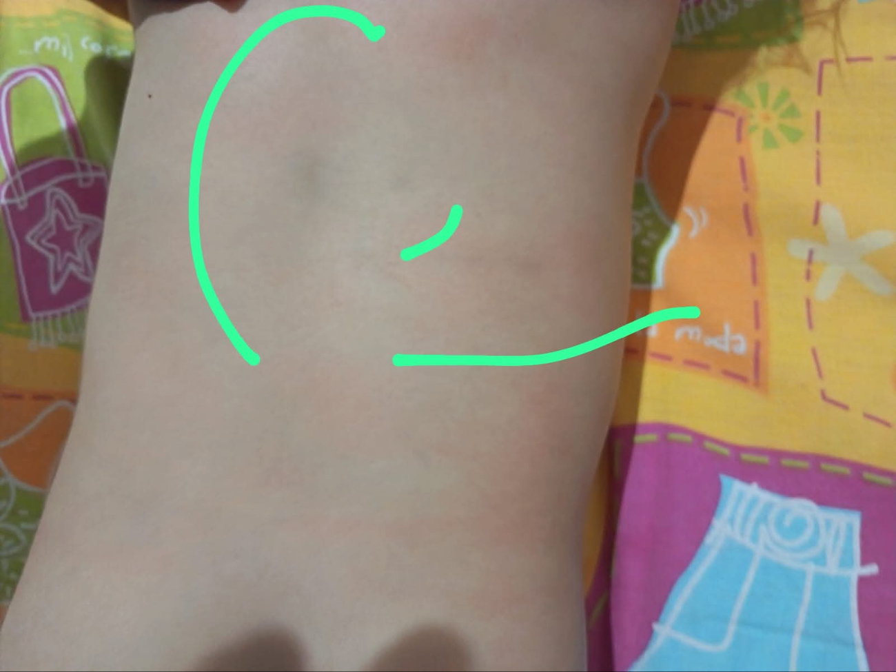 Los menores afectados ya reciben atención integral por posibles afectaciones emocionales.