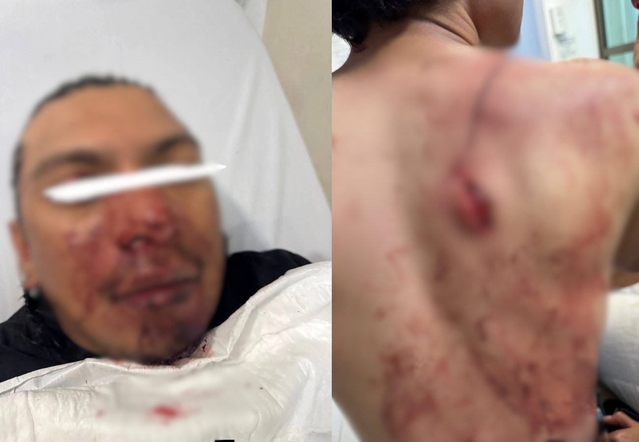 La víctima reportó que los guardias del establecimiento no actuaron para detener las agresiones