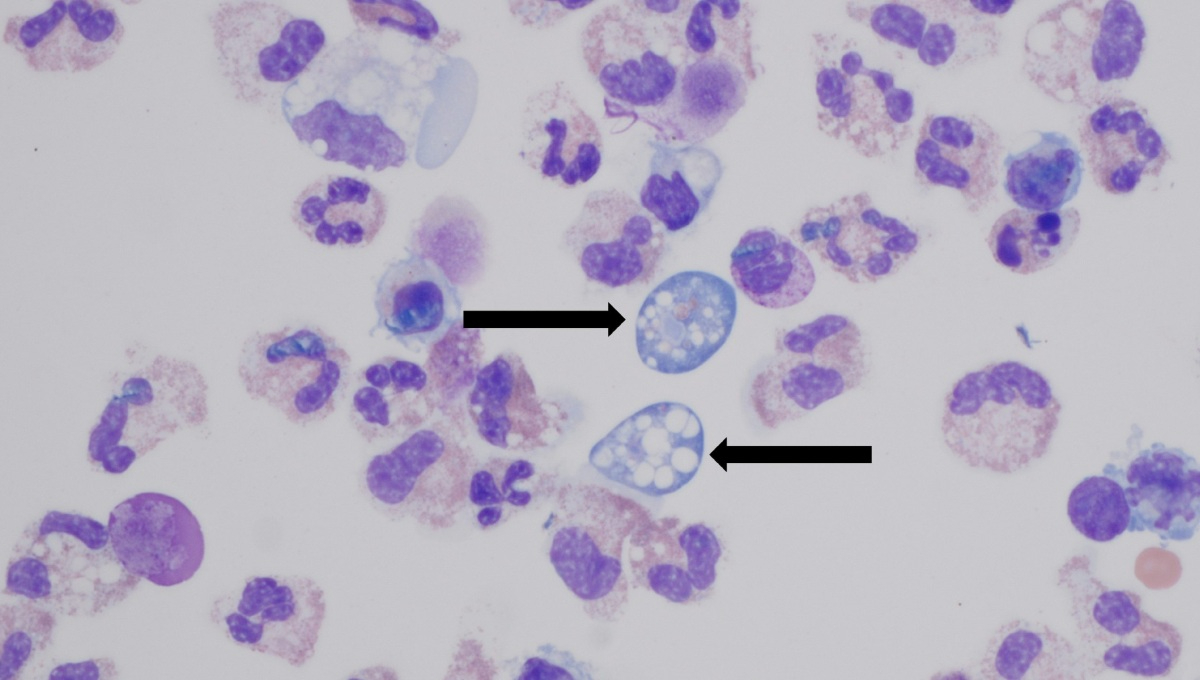 Por esta razón es peligrosa la ameba Naegleria.