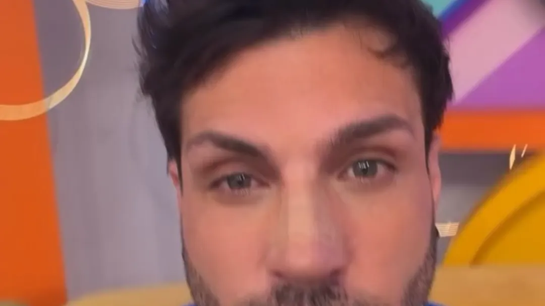 Nicola Porcella muestra cómo luce su nueva nariz en redes.