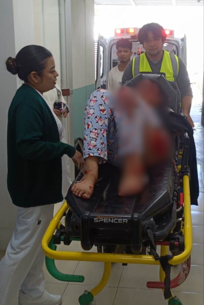 Autoridades advierten sobre el uso de ropa suelta al conducir motocicleta.