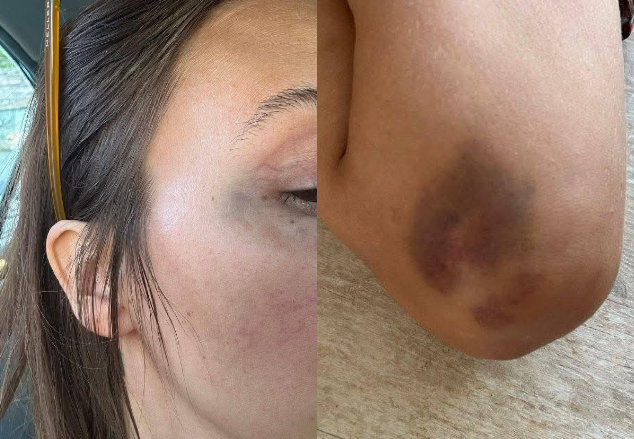 La víctima denunció la reclasificación de su caso