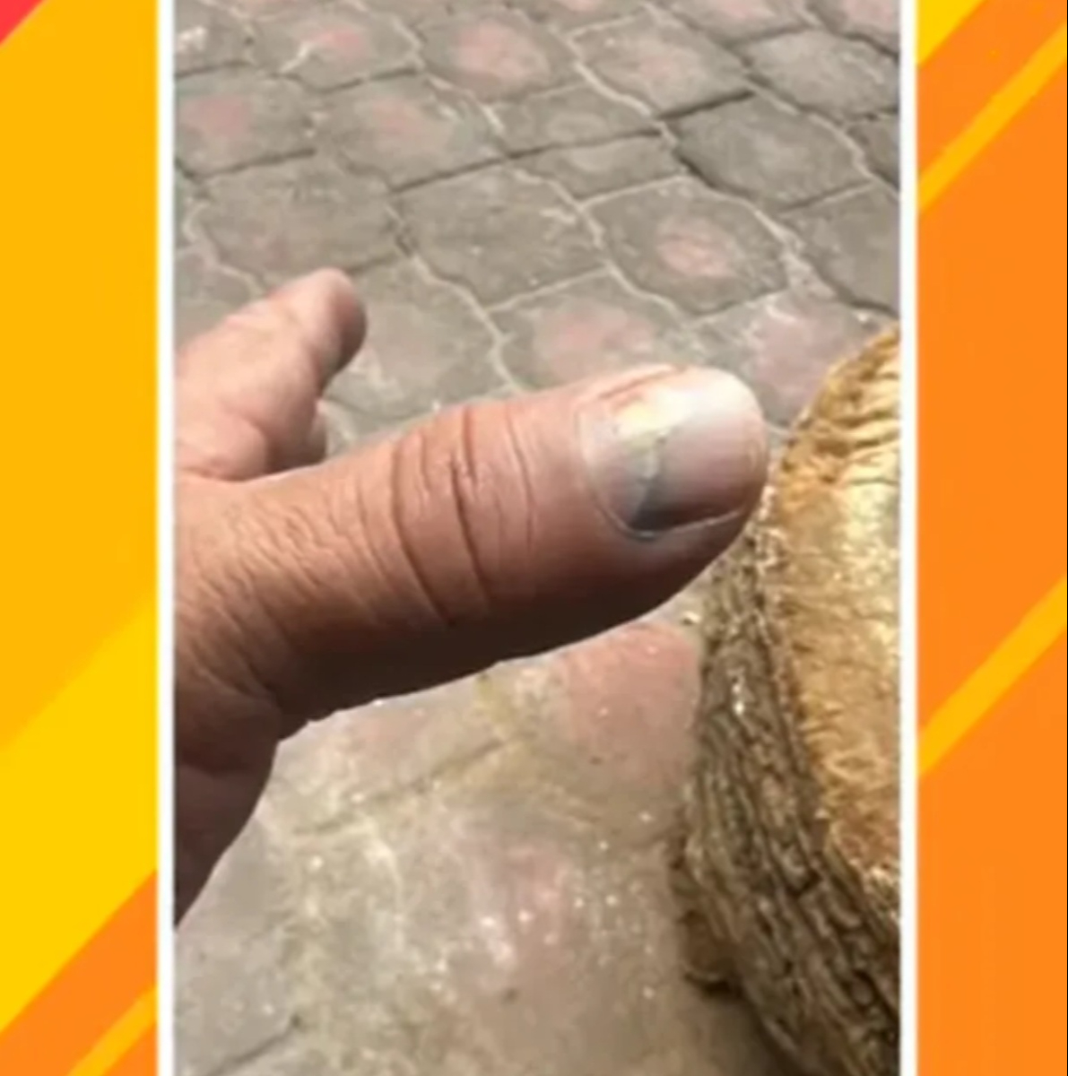 Mano de Carlos Trejo tras ataque afuera de su casa.