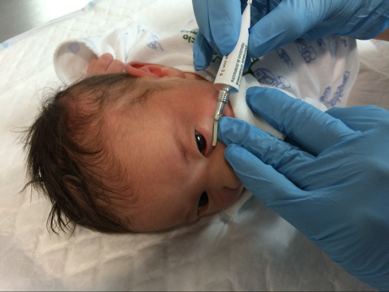 Conjuntivitis en la península: Campeche al alza, Yucatán estable, Quintana Roo a la baja