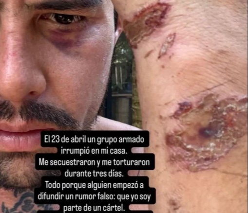 El joven compartió su testimonio por medio de redes sociales