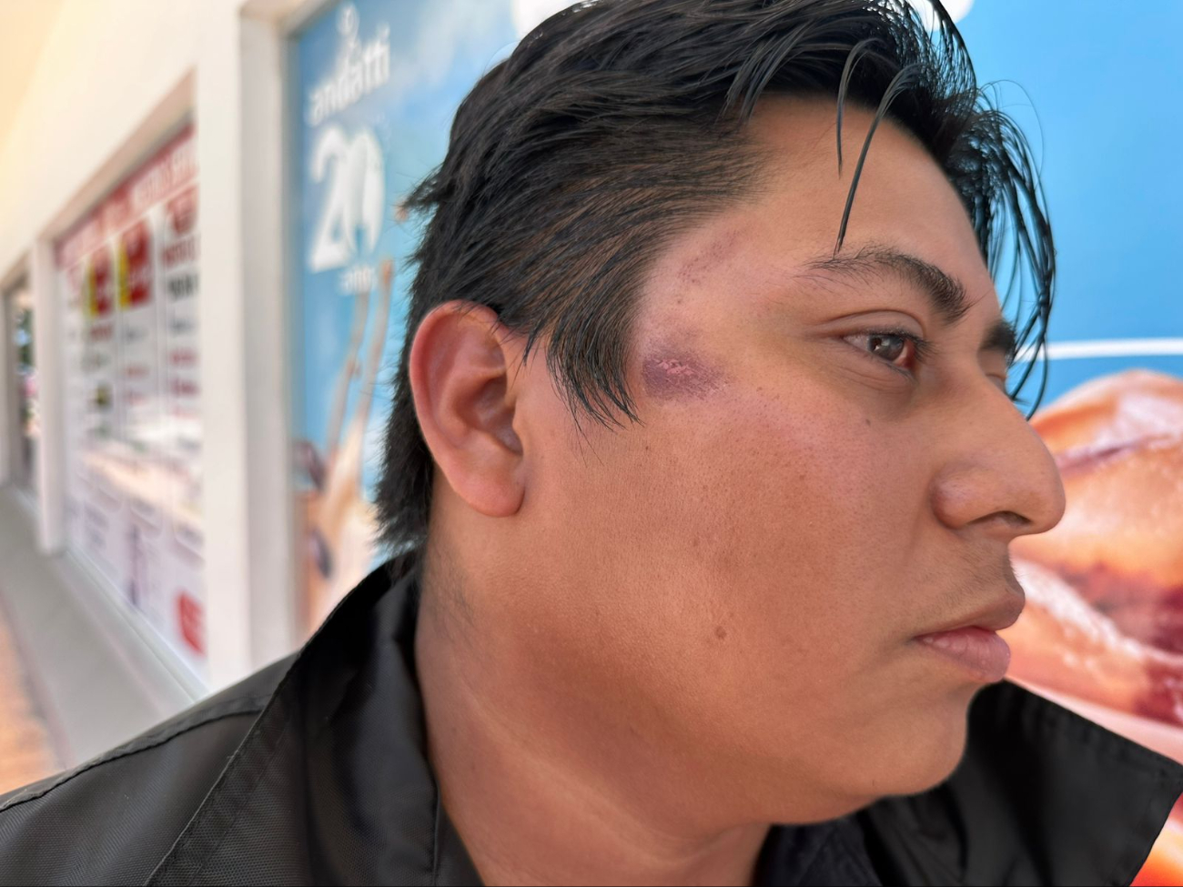 Acusa una presunta agresión durante un procedimiento policial.