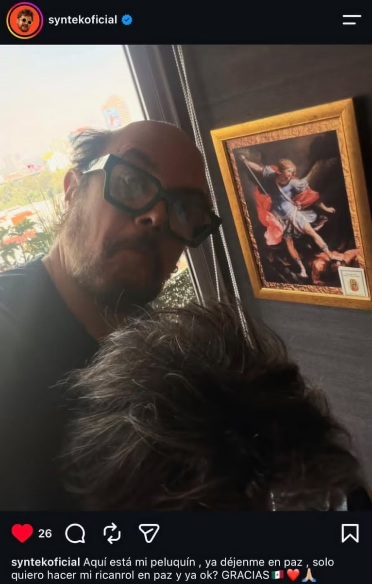 Aleks Syntek se muestra sin peluquín.