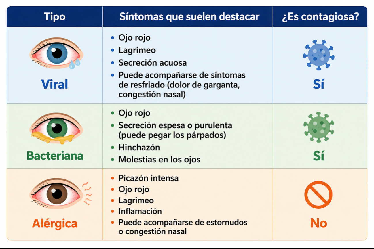 Picazón, lagañas u ojos llorosos: qué tipo de conjuntivitis podría ser