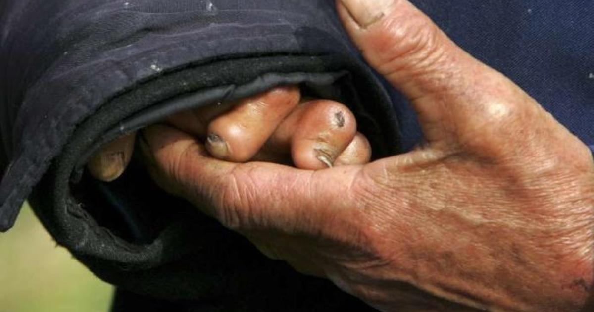 Yucatán es el segundo estado en la península con más casos Foto: Reuters