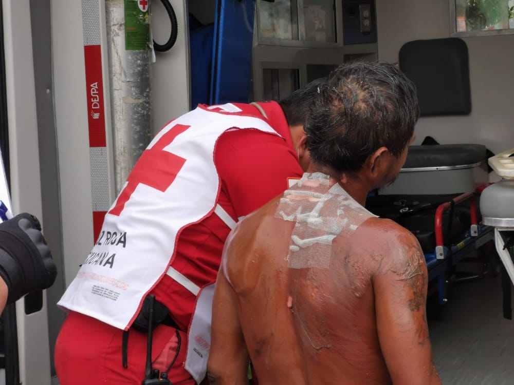 Sufre quemaduras graves; le arrojaron caldo hirviendo en Ciudad del Carmen