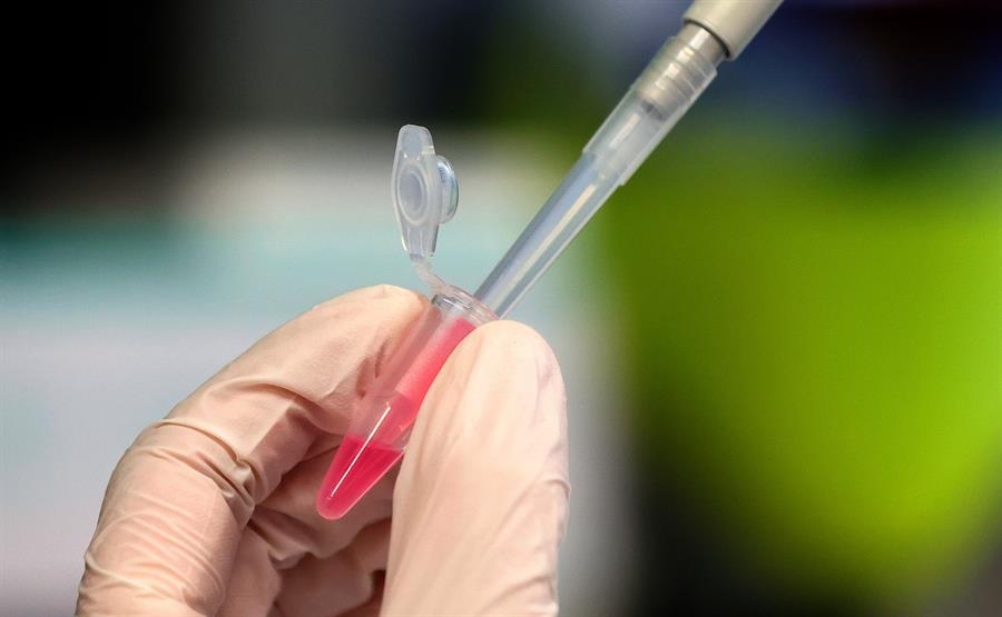 Los científicos aún no logran determinar el tiempo que dura la inmunidad en una persona tras recuperarse del COVID-19 (EFE) Los científicos aún no logran determinar el tiempo que dura la inmunidad en una persona tras recuperarse del COVID-19 (EFE)
