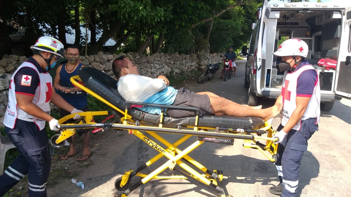 El motociclista terminó con lesiones en la cara y el hombro Foto: Carlos Euan El motociclista terminó con lesiones en la cara y el hombro Foto: Carlos Euan
