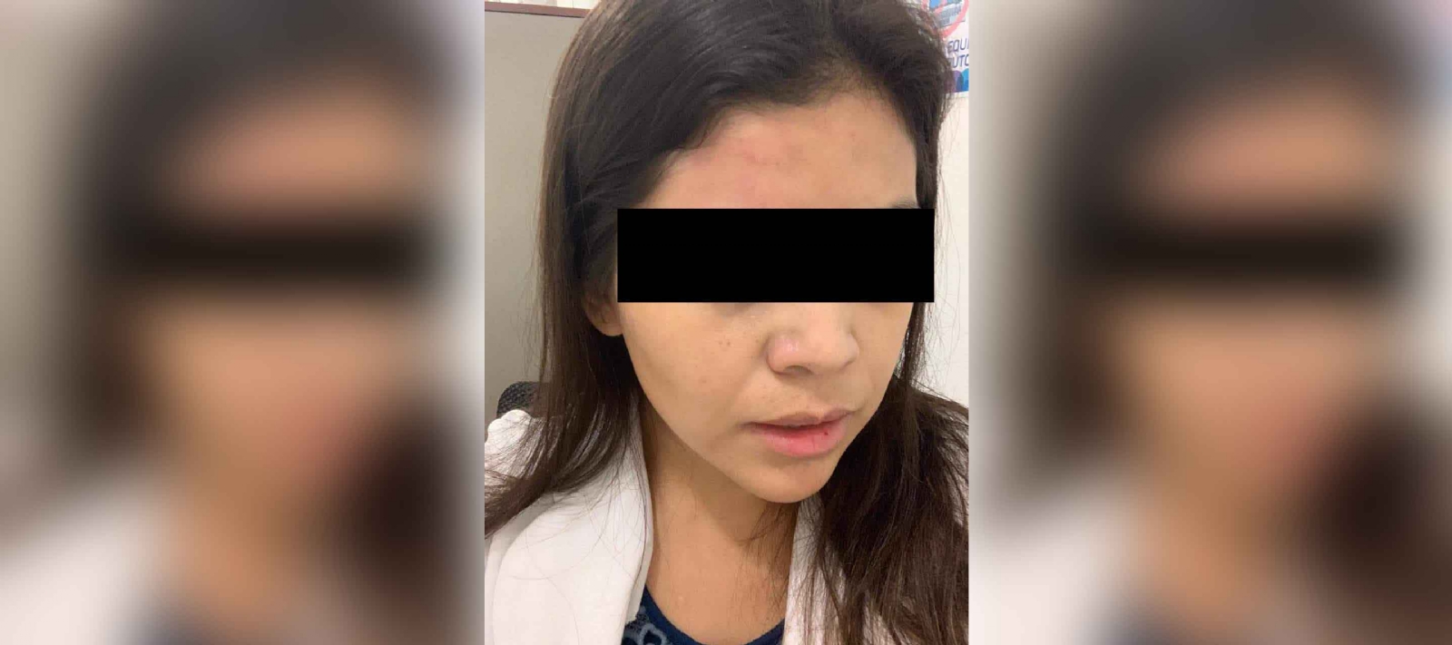 Paciente psiquiátrico golpea a doctora en Valladolid