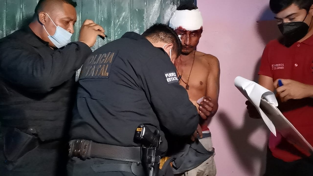 Los habitantes golpearon al hombre hasta dejarlo seriamente herido Los habitantes golpearon al hombre hasta dejarlo seriamente herido