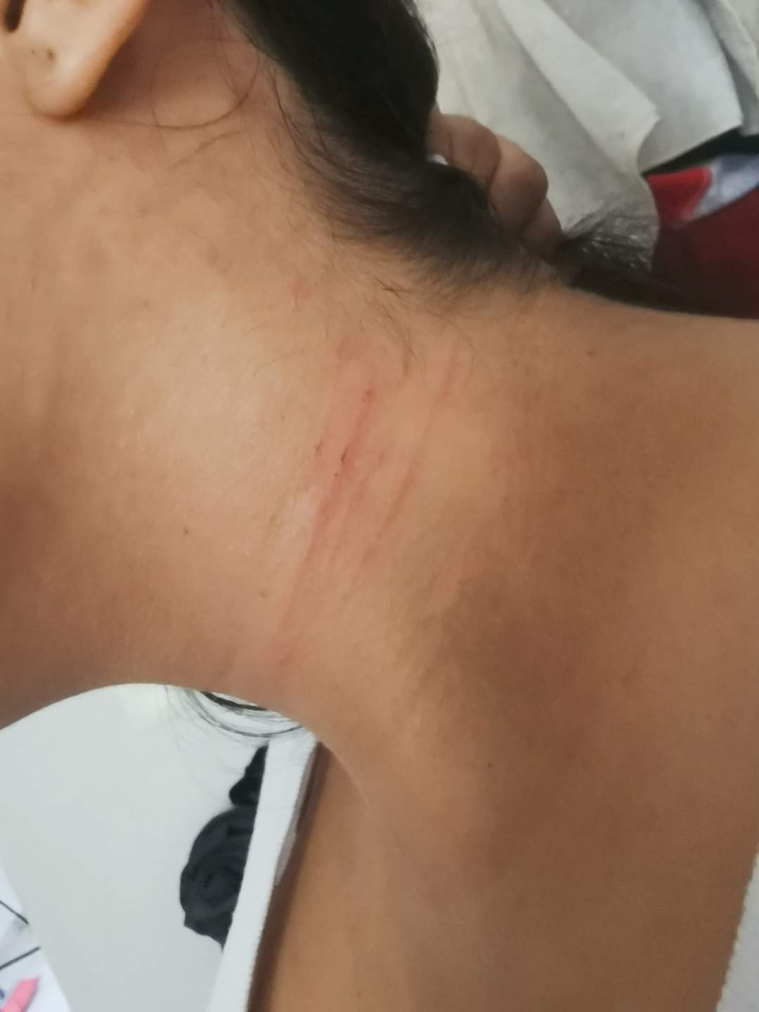 El maleante intentó despojarla de su ropa, dejándole rasguños El maleante intentó despojarla de su ropa, dejándole rasguños