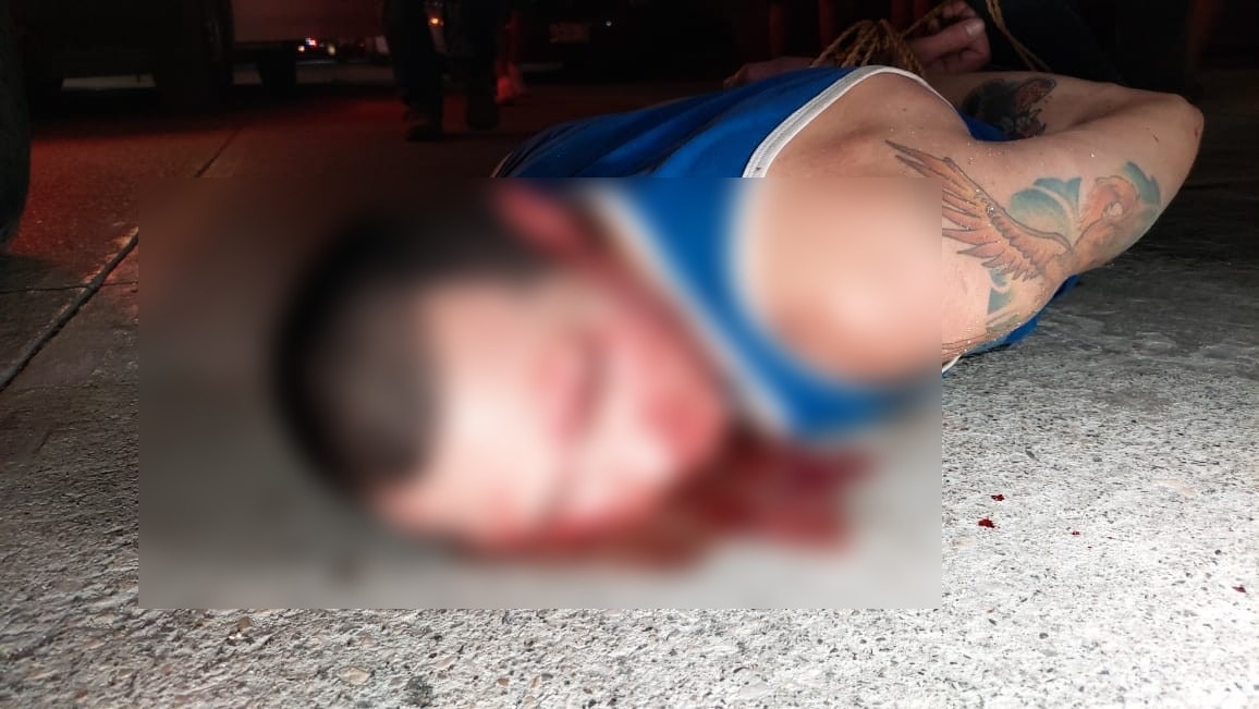 Al lugar arribó la Cruz Roja, quiénes le dieron prioridad a la mujer que presentaba una herida de gravedad en el rostro