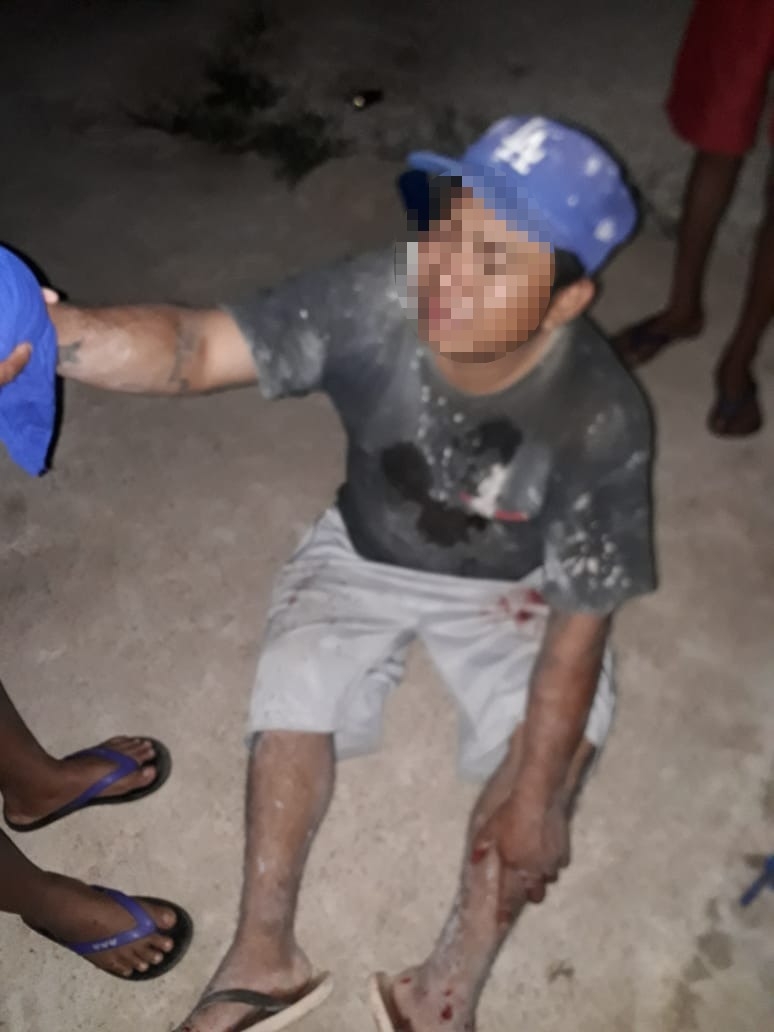 Pese a las lesiones, el herido no perdió ningún dedo Pese a las lesiones, el herido no perdió ningún dedo
