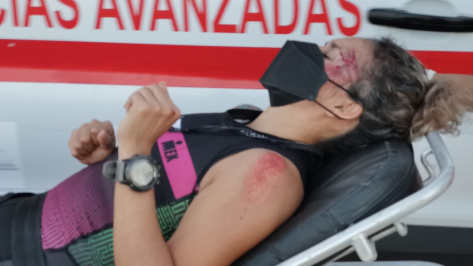 Los hechos ocurrieron alrededor de las 14:10 horas, cuándo sobre el kilómetro 27 de la carretera carmen-puerto real