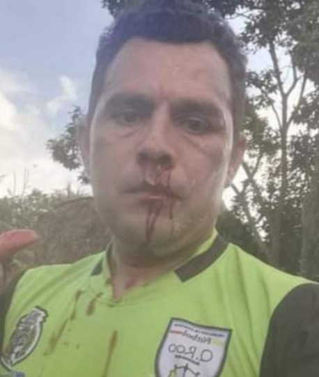 La agresión dejó tirado al árbitro en el campo, además que se tuvo que suspender el partido