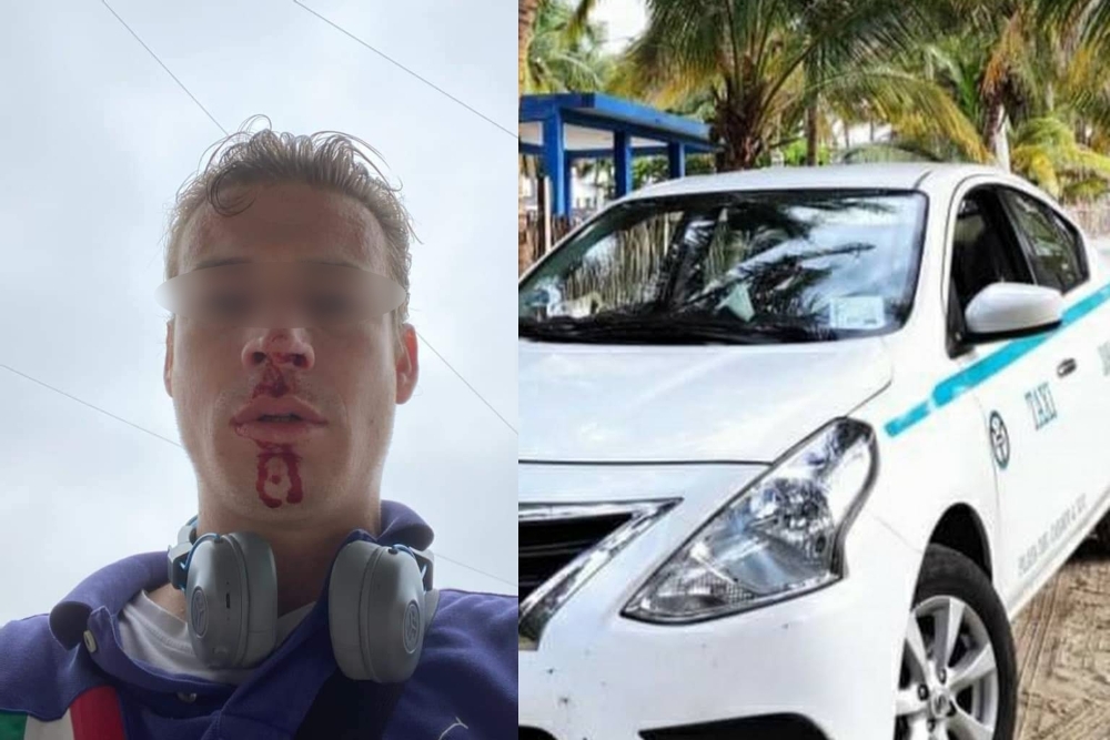 La pareja del agredido denunció en redes sociales el ataque que sufrió el hombre por parte de un taxista de Playa del Carmen