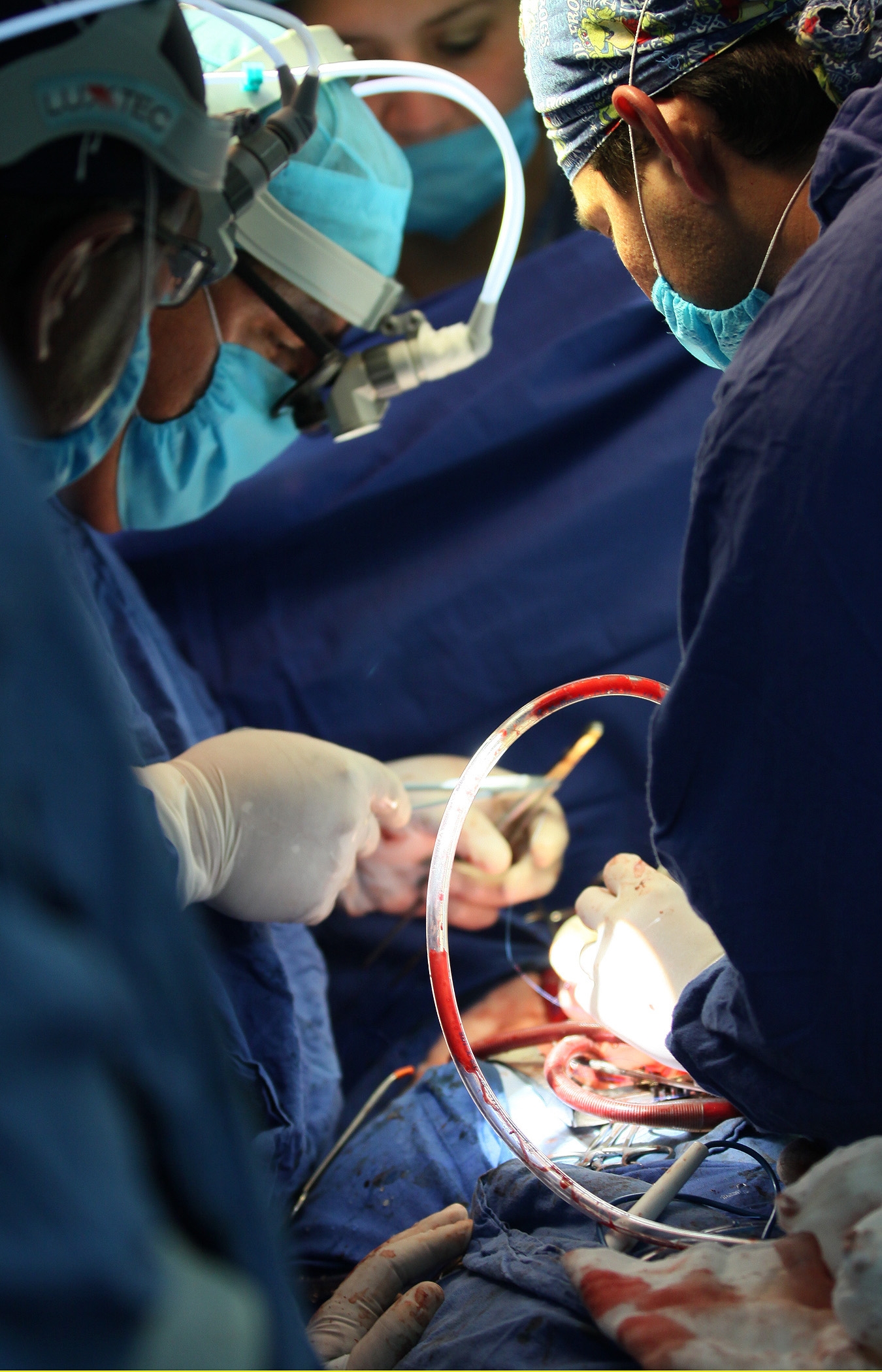 El trasplante de corazón lo realizó un equipo de especialistas de la Unidad Médica de Alta Especialidad del IMSS en la CDMX El trasplante de corazón lo realizó un equipo de especialistas de la Unidad Médica de Alta Especialidad del IMSS en la CDMX