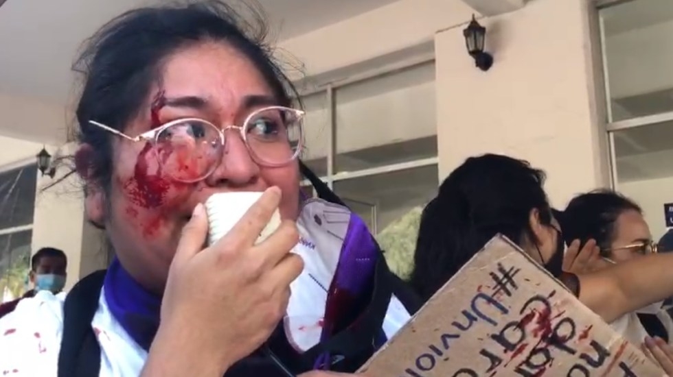 La activista feminista fue agredida durante una trifulca La activista feminista fue agredida durante una trifulca