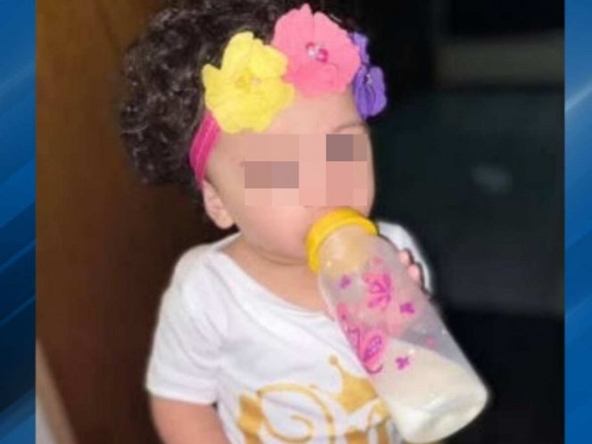 El perro mordió a la niña en la cabeza porque lo molestó mientras comía El perro mordió a la niña en la cabeza porque lo molestó mientras comía
