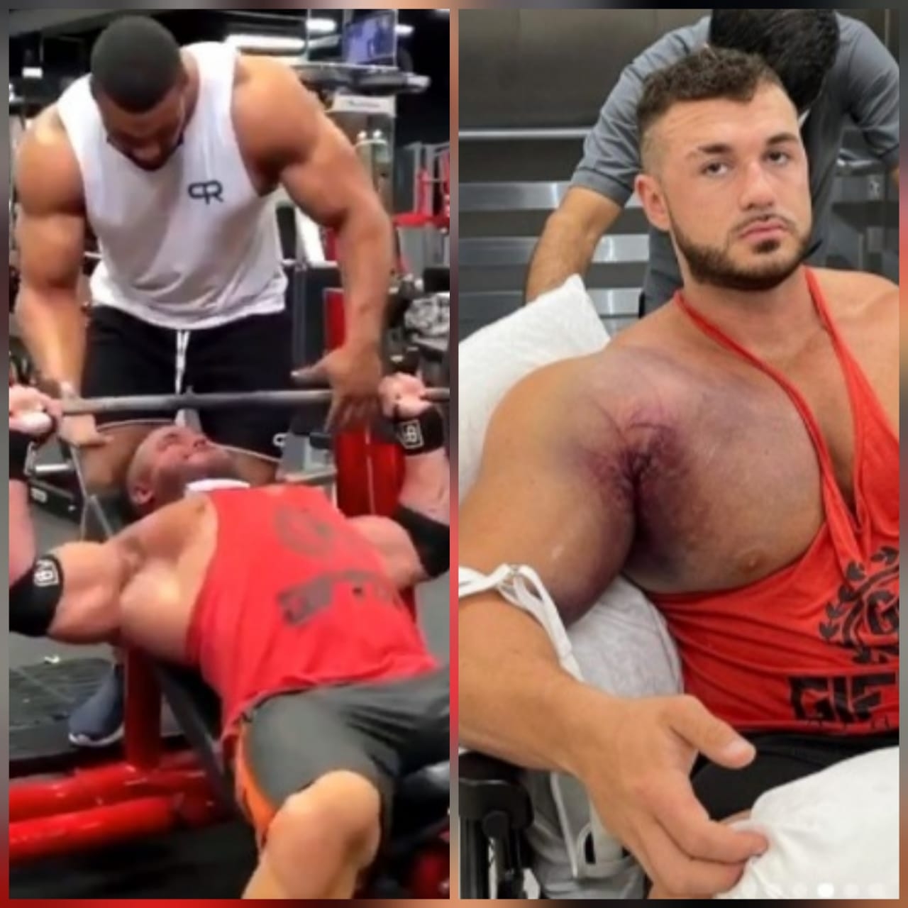 Ryan Crowley, antes y después de la lesión Ryan Crowley, antes y después de la lesión