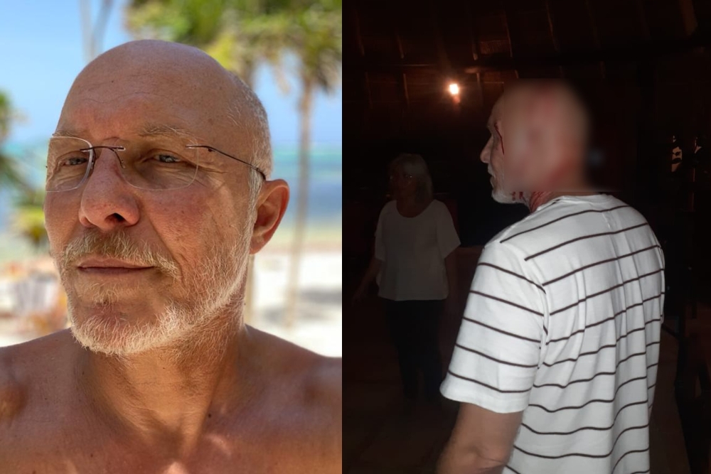 El hotelero sufrió un golpe durante el asalto armado en Tulum El hotelero sufrió un golpe durante el asalto armado en Tulum