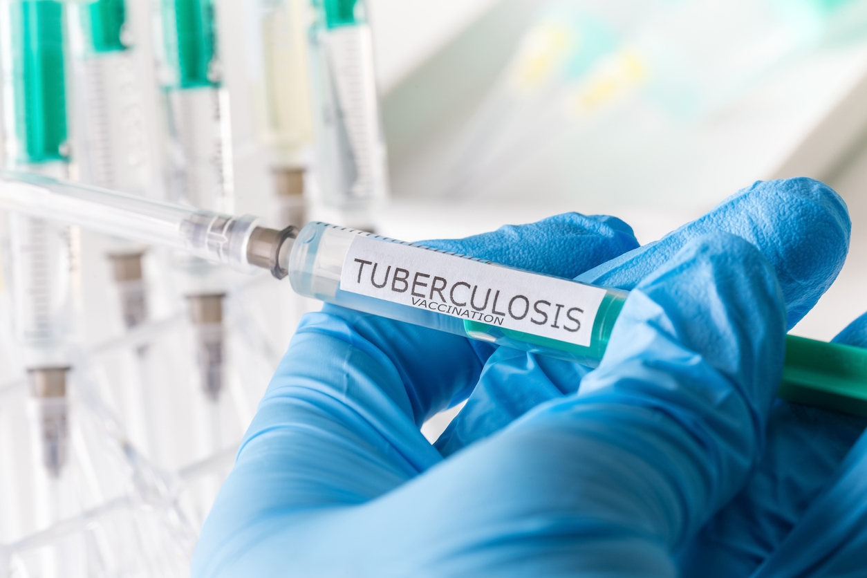 Las vacunas contra la tuberculosis son importantes Las vacunas contra la tuberculosis son importantes