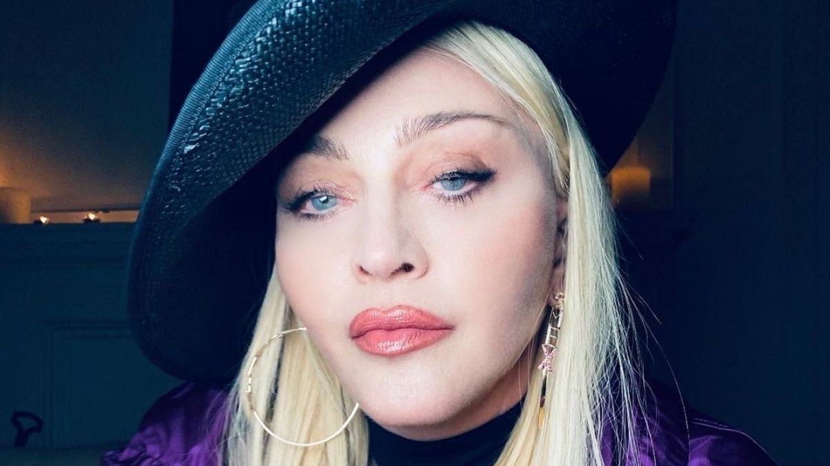 Madonna ha sido criticada por sus múltiples cirugías en los últimos meses. Foto: Especial